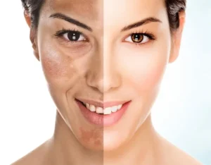 Clinica de Estética em Criciúma